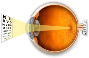 miopie și nas viziune spirală în ochi